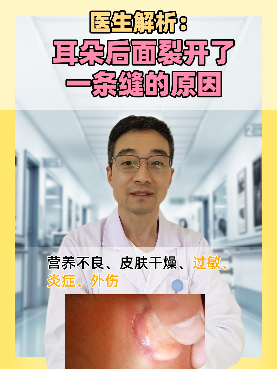 医生解析：耳朵后面裂开了一条缝的原因