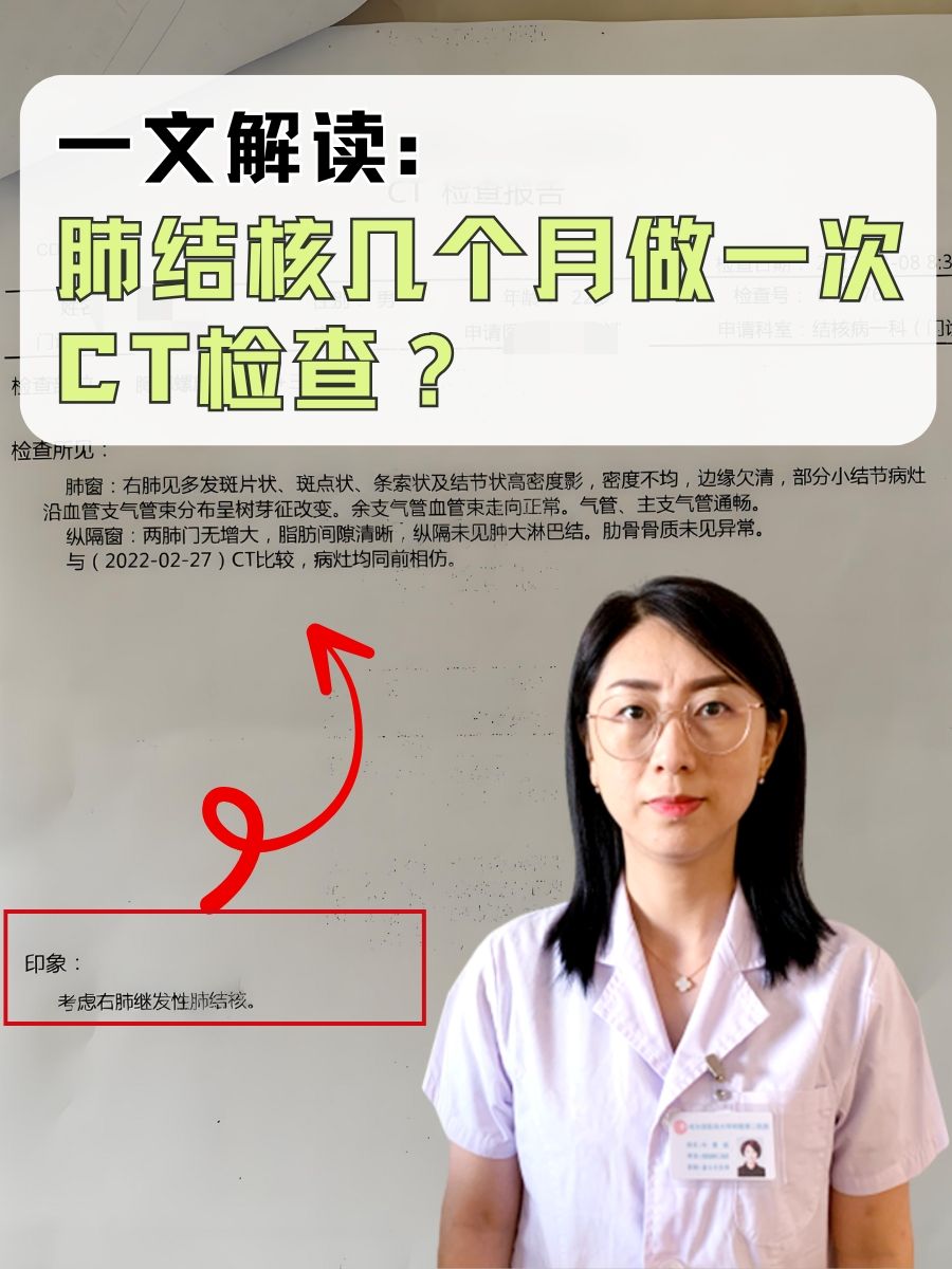 一文解读：肺结核几个月做一次CT检查？