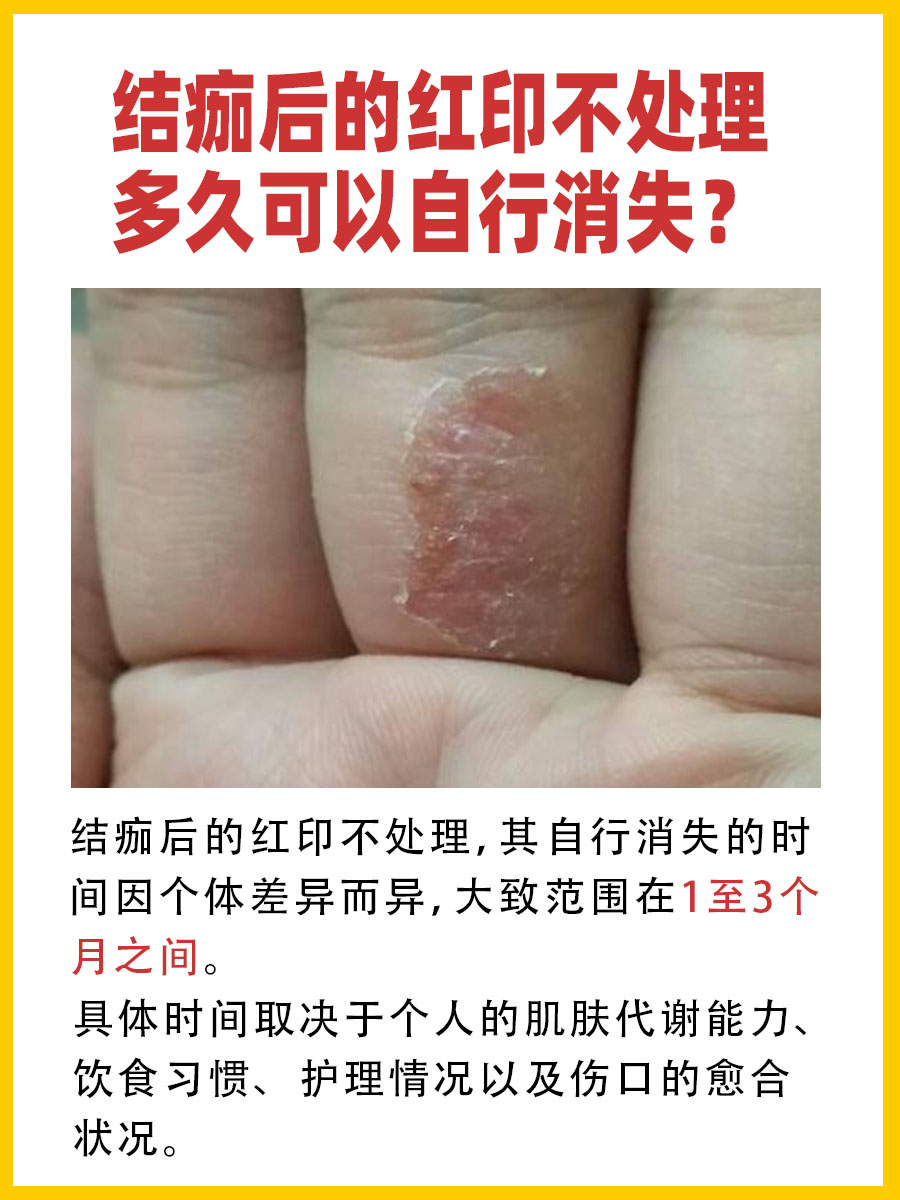 结痂脱落后的红印，怎样快速去除？