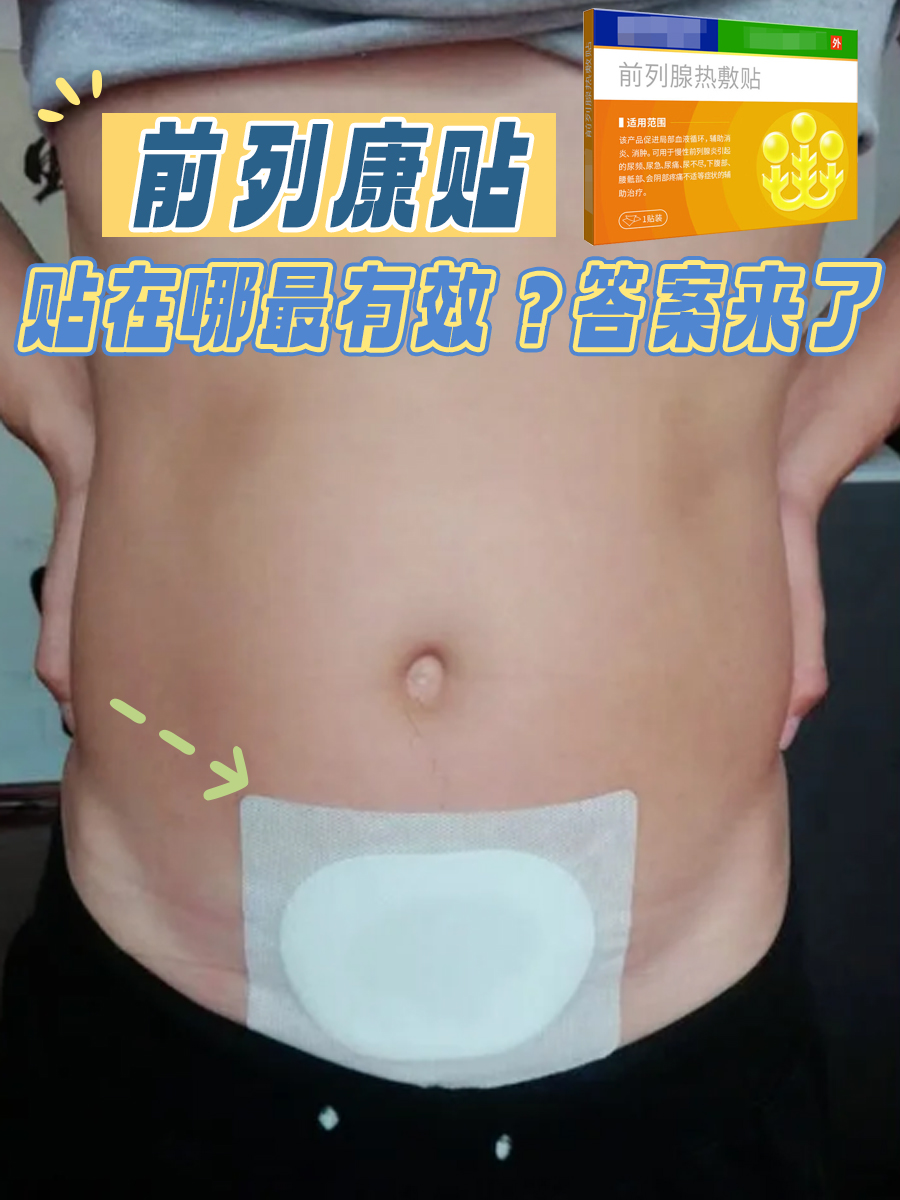 前列康贴贴在哪最有效？答案来了