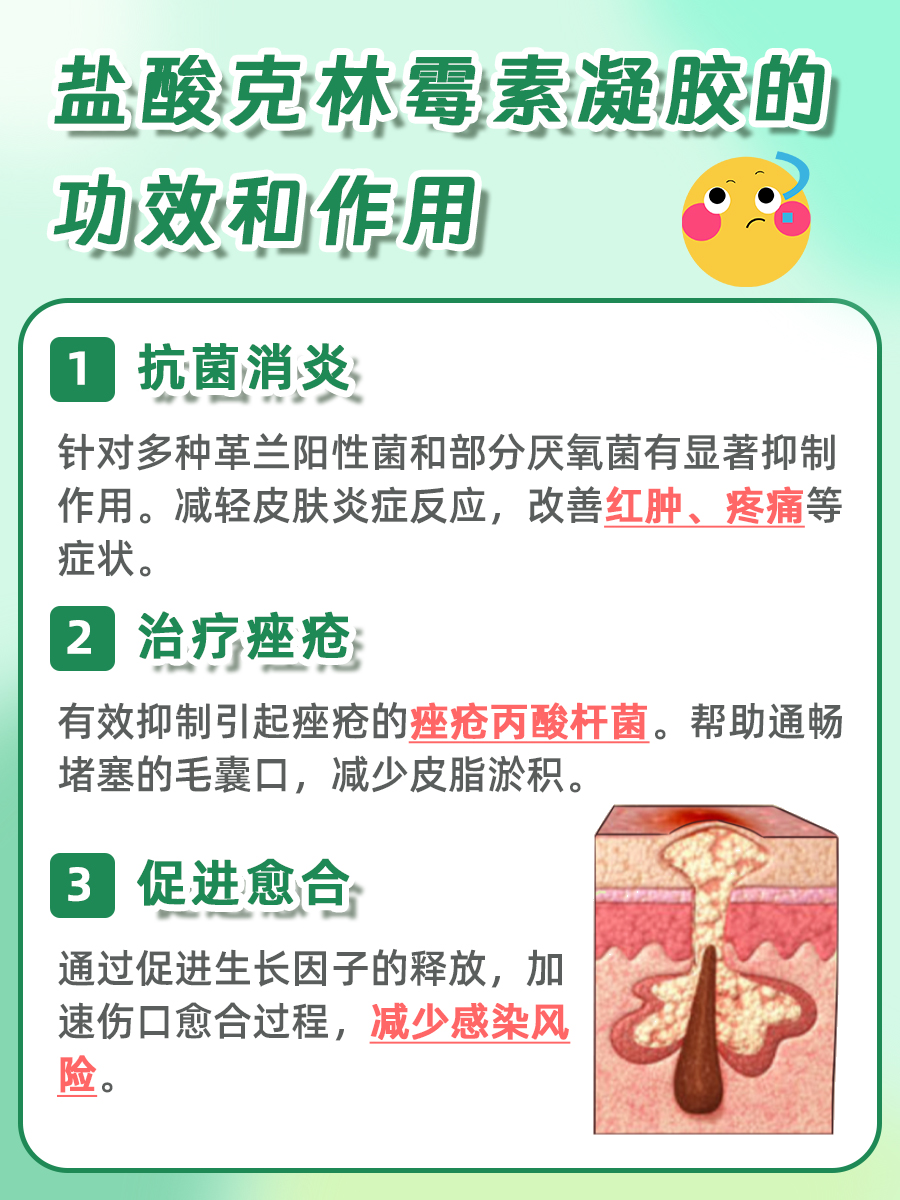 盐酸克林霉素凝胶：医生告诉你功效和作用