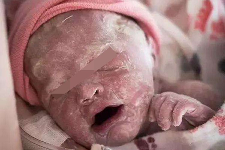 新生儿白色肤色图
