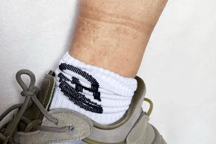 脚踝处有一圈勒痕图片_有来医生