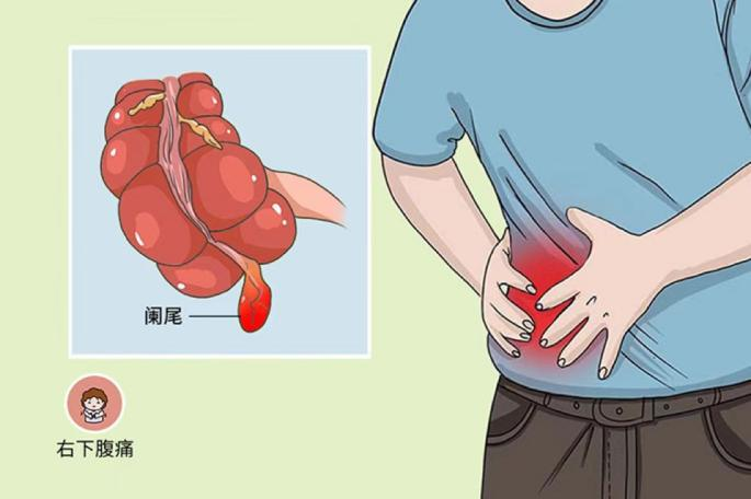 右下腹痛图