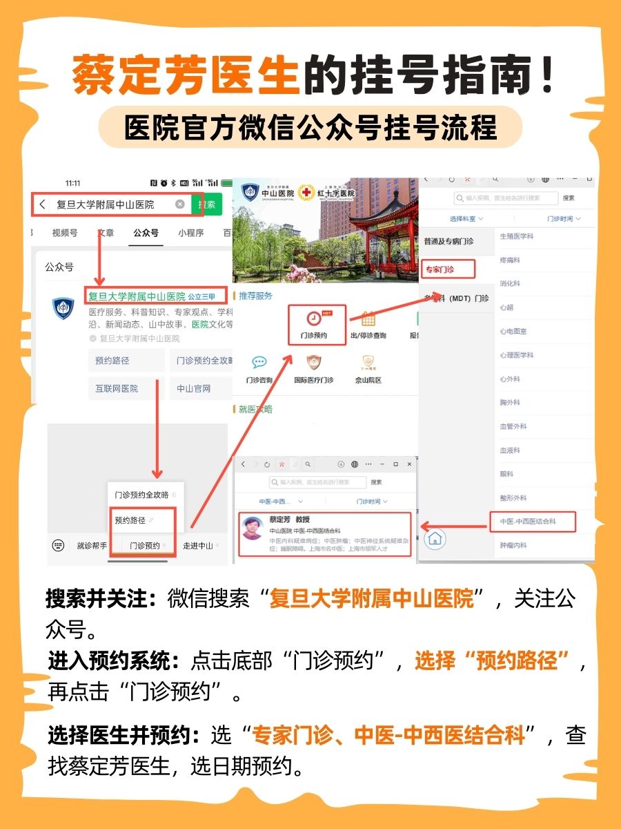 上海中山医院蔡定芳医生怎么样?怎么挂号?