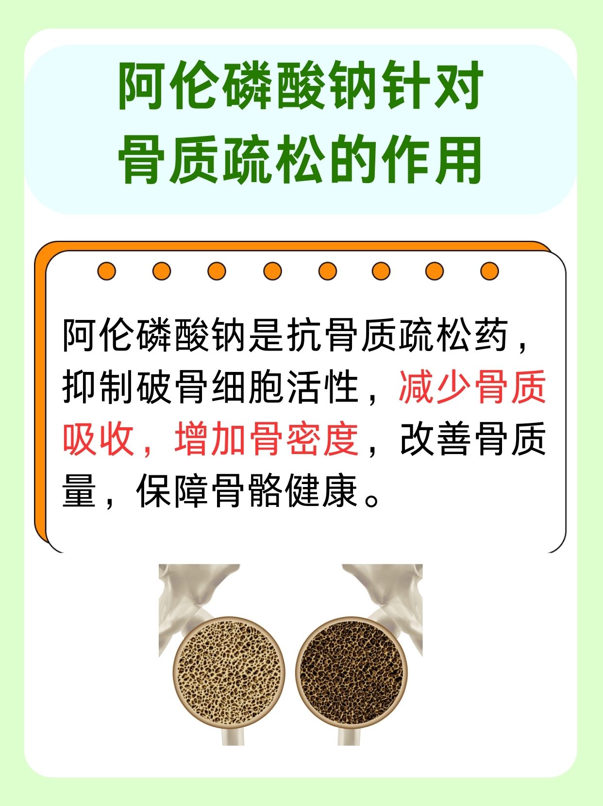 揭秘：阿伦磷酸钠针对骨质疏松的作用