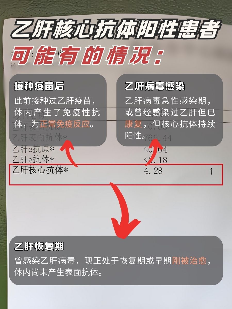 乙肝核心抗体高于950PEIU/ml，严重吗
