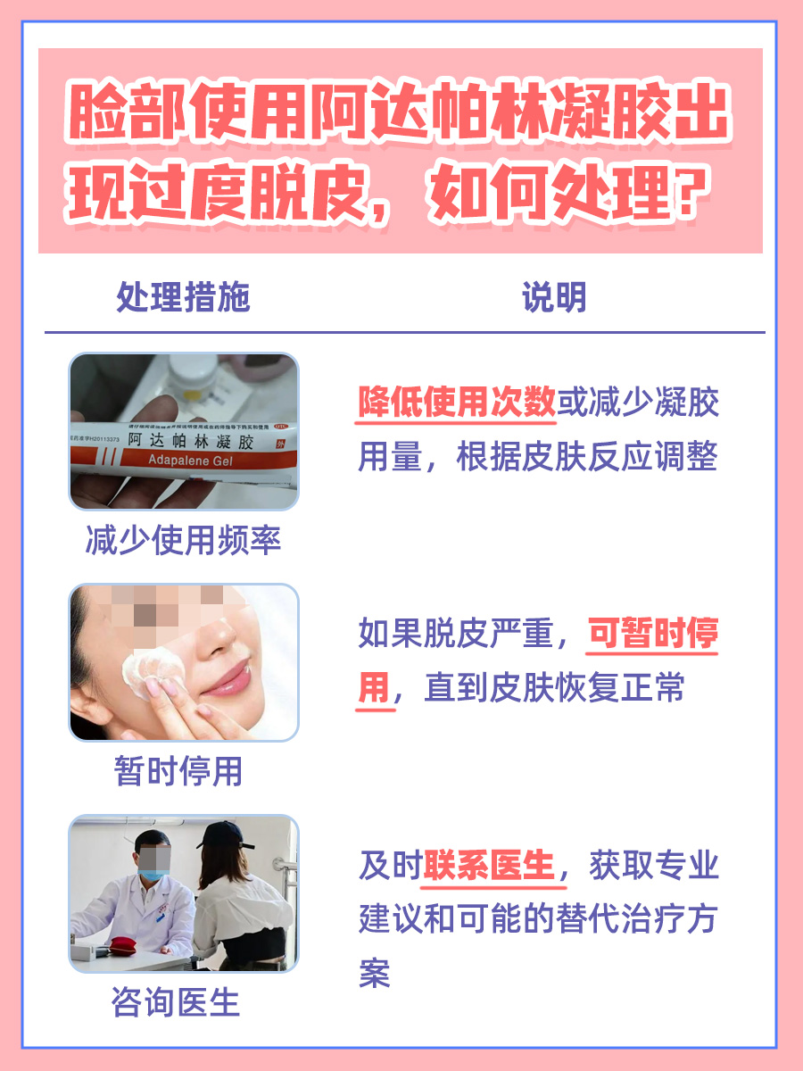 使用阿达帕林凝胶，脸脱皮是好现象吗？
