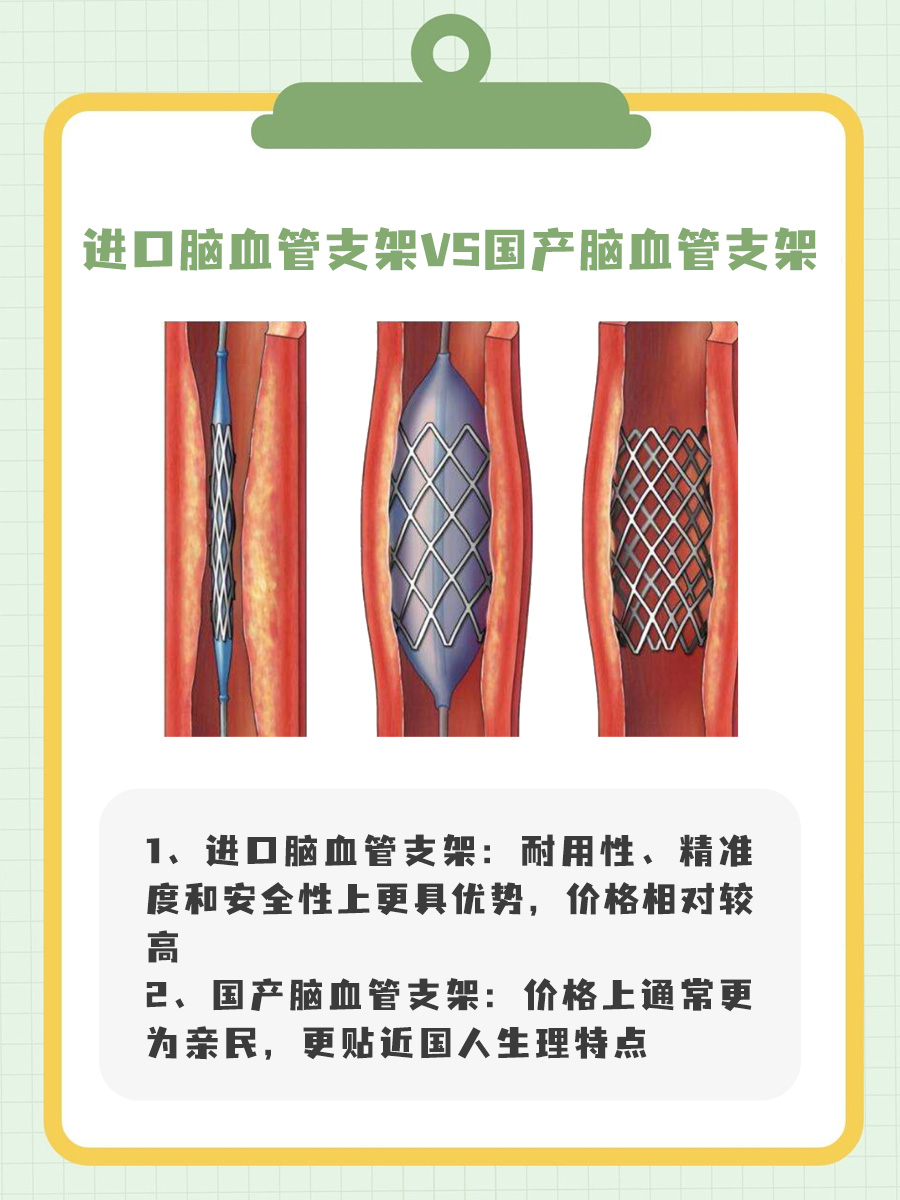 脑血管支架：进口VS国产，有什么区别？