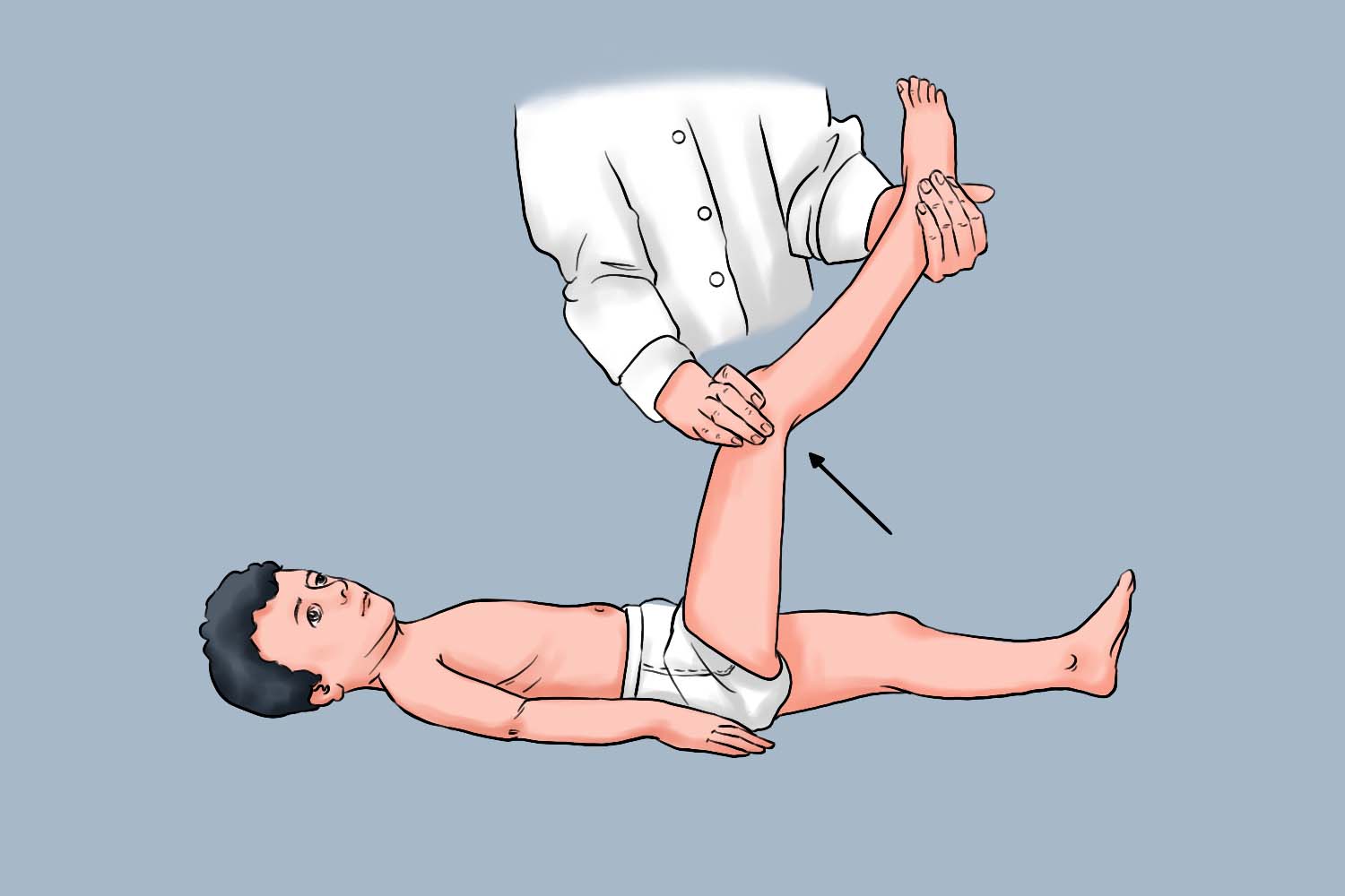 凯尔尼格征图 凯尔尼格征图