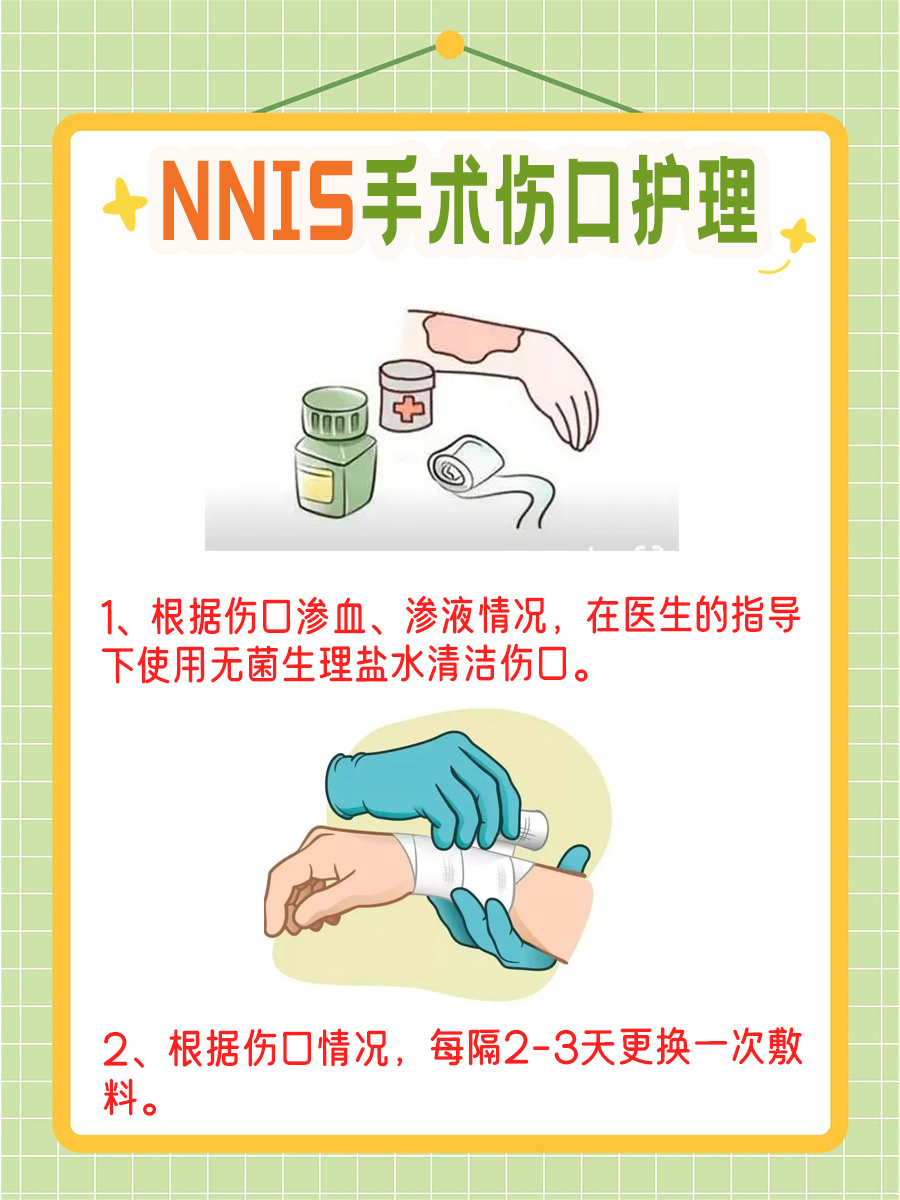 全面了解:NNIS手术风险分级标准