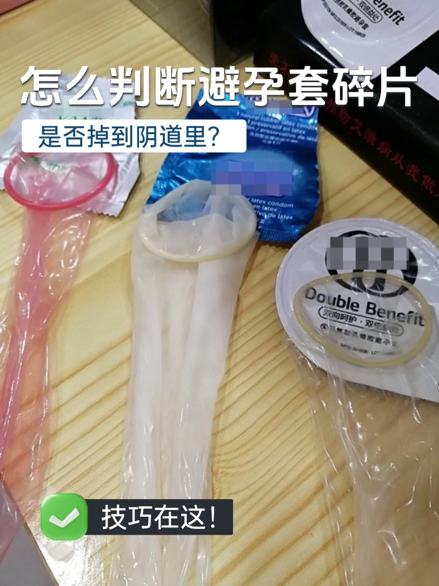 阴道 怎么判断避孕套碎片是否掉到阴道里？技巧在这！-有来医生