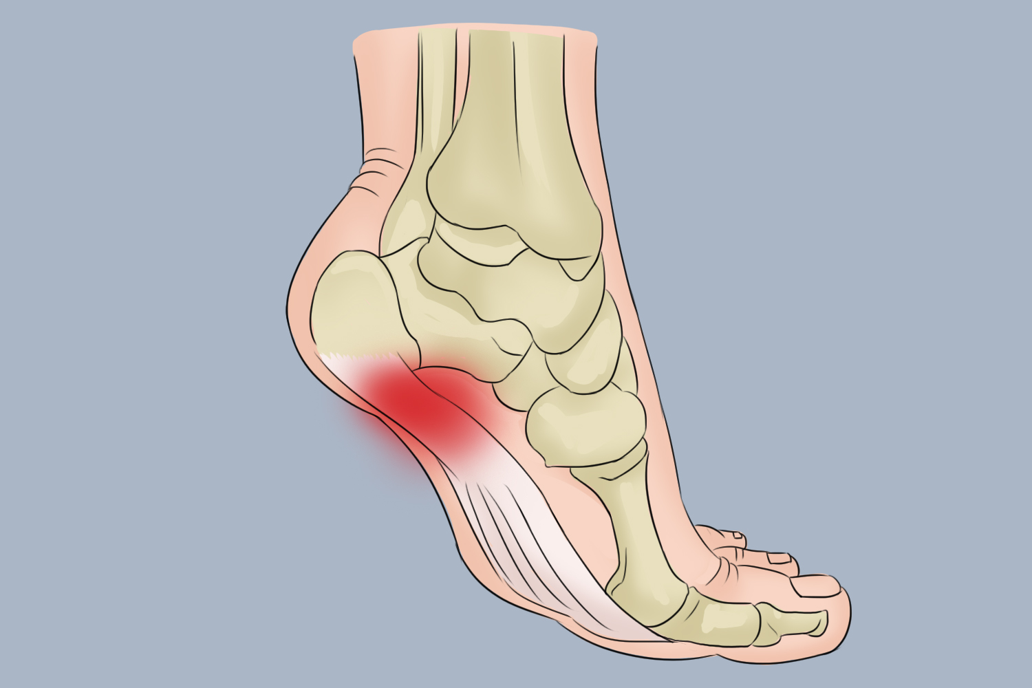 右脚扁平足内侧疼痛部位图