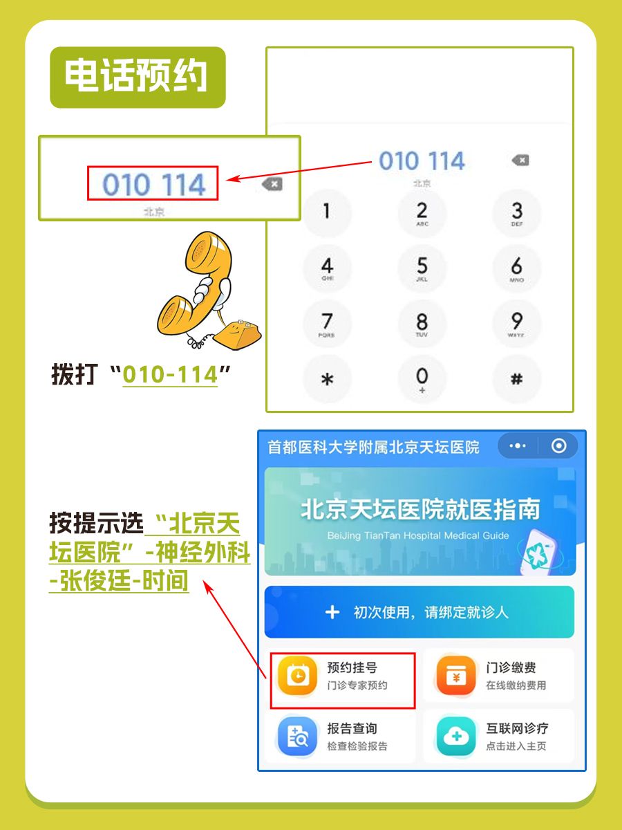 北京天坛医院张俊廷医生怎么样？怎么挂号？