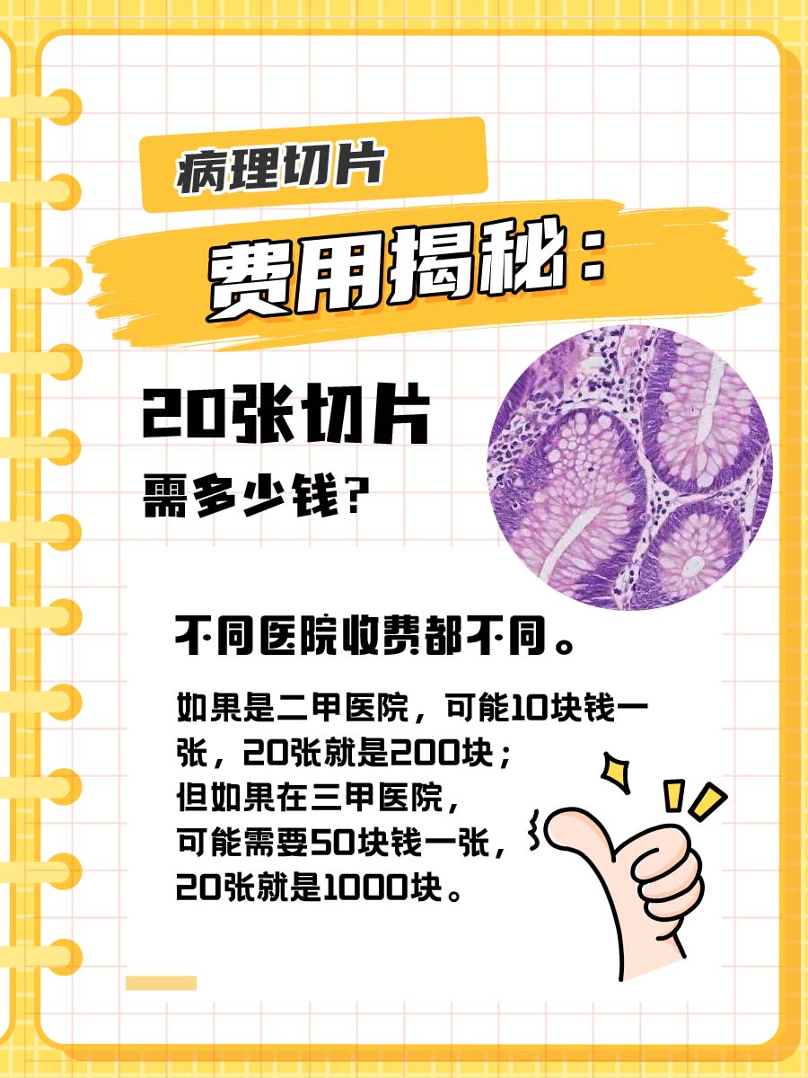病理切片费用揭秘：20张切片需多少钱？