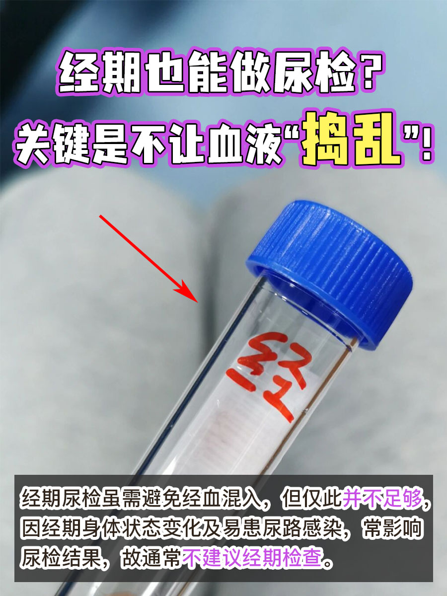 经期也能做尿检？关键是不让血液“捣乱”！