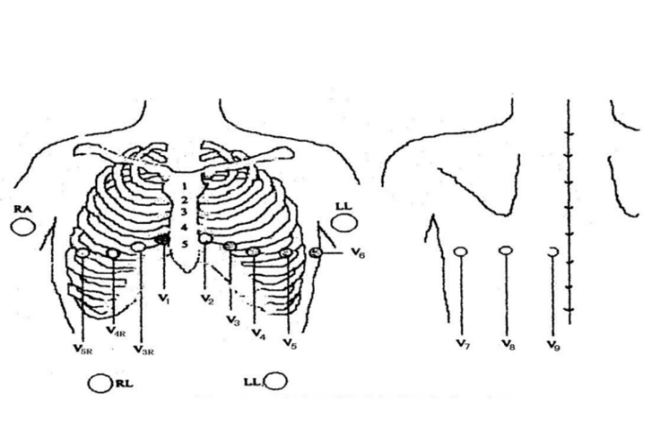 18导联心电图位置顺序图