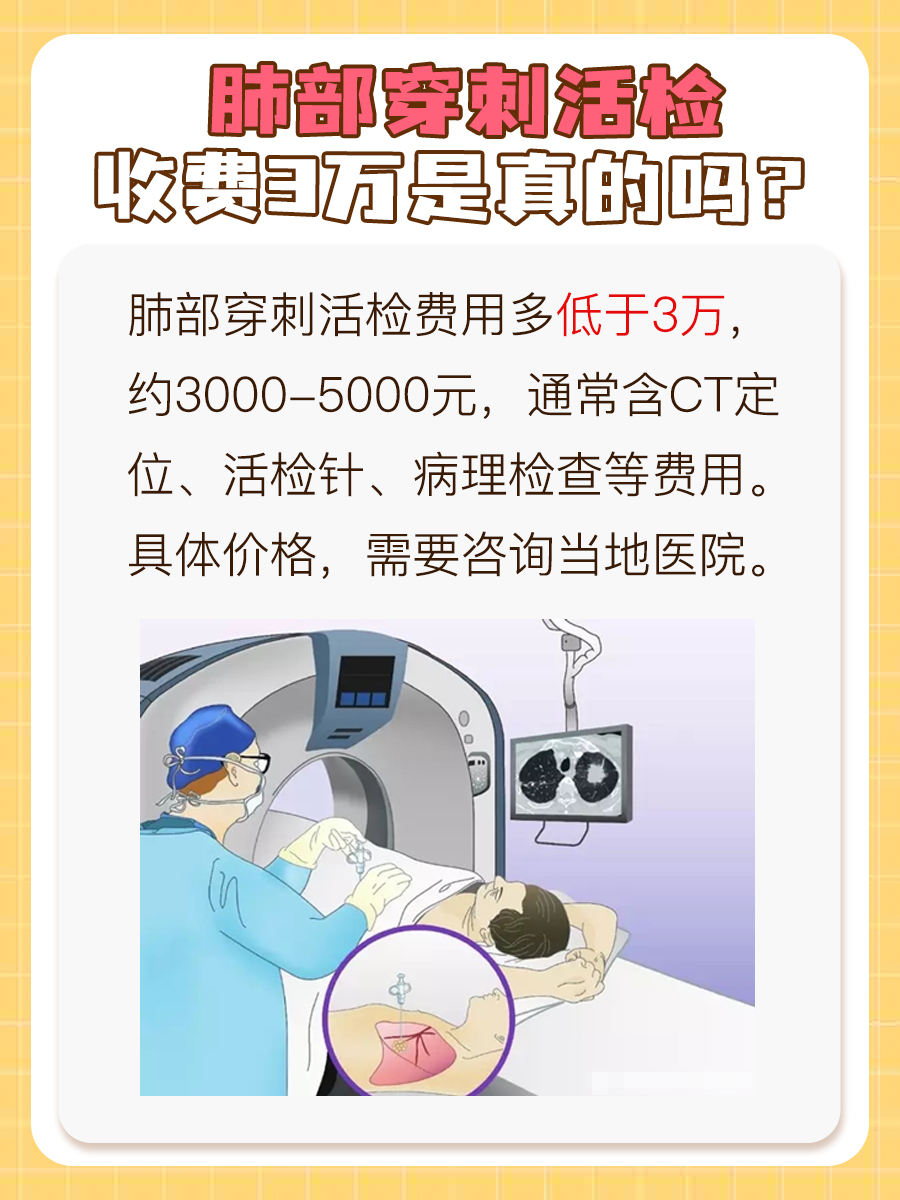肺部穿刺活检收费3万：这是真的吗