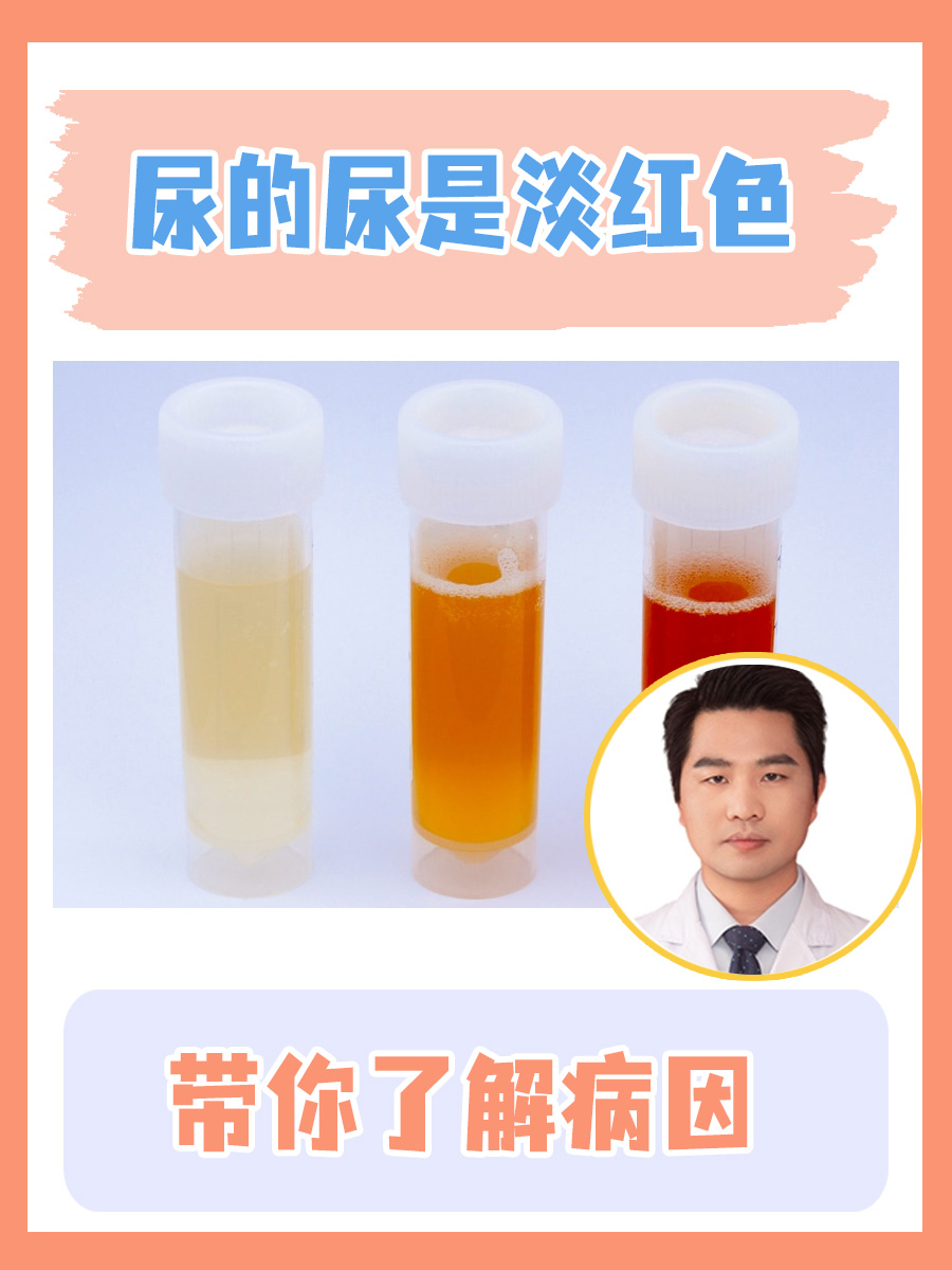 尿的尿是淡红色：带你了解病因