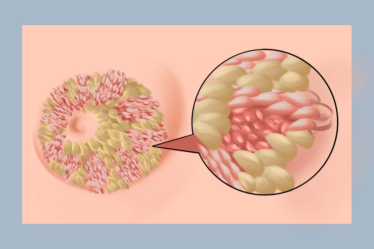 乳腺小叶位置图 乳腺小叶位置图