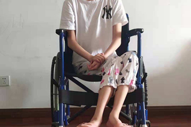 肌肉萎缩腿症状图 肌肉萎缩腿症状图