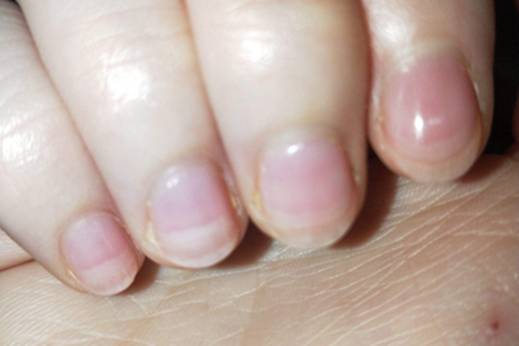 甲分离甲板分层后发白图