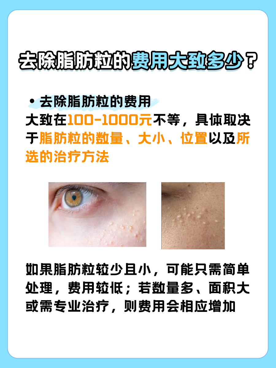 去除脂肪粒的费用，你了解吗？