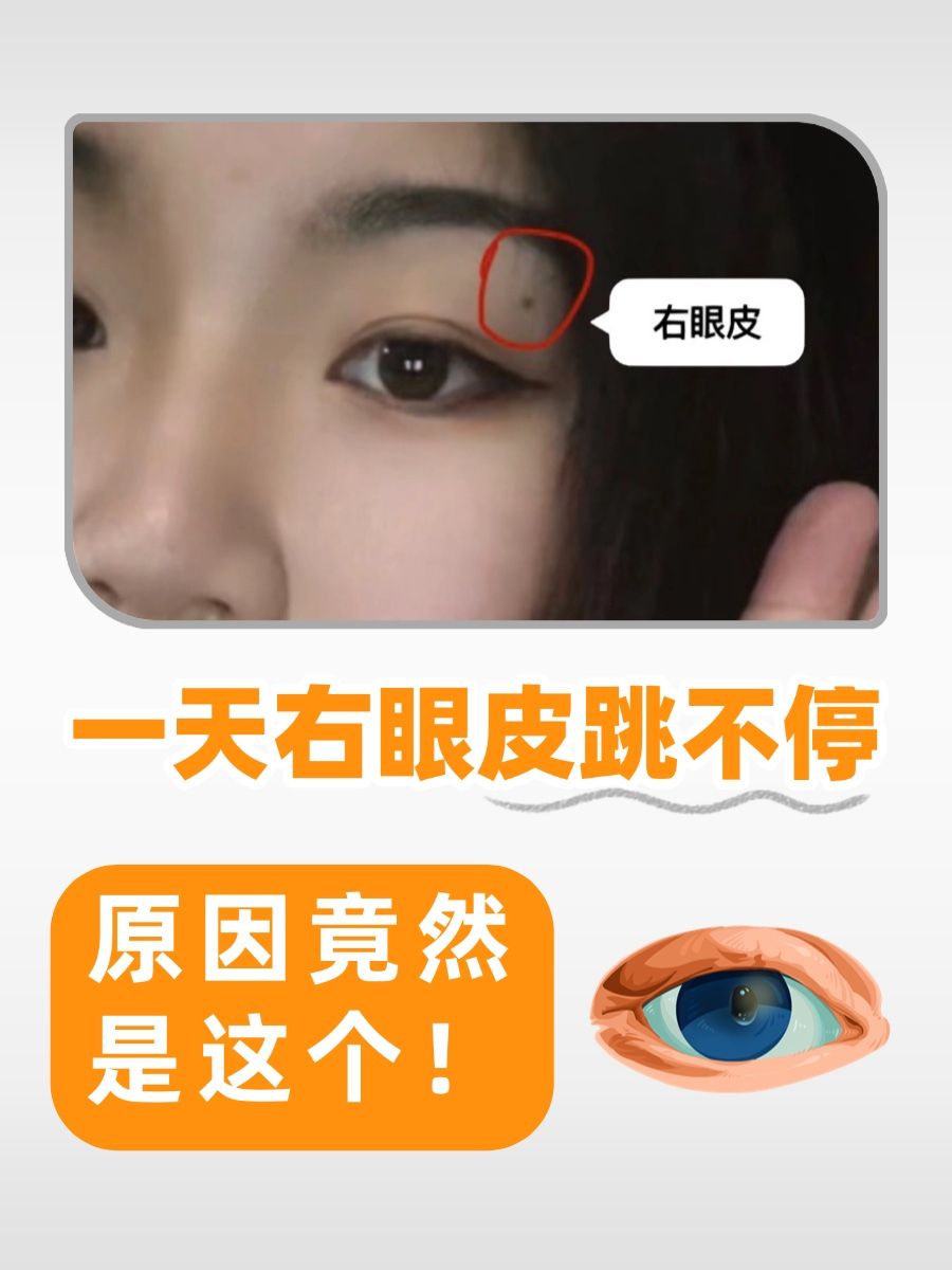 一天右眼皮跳不停,原因竟然是这个!