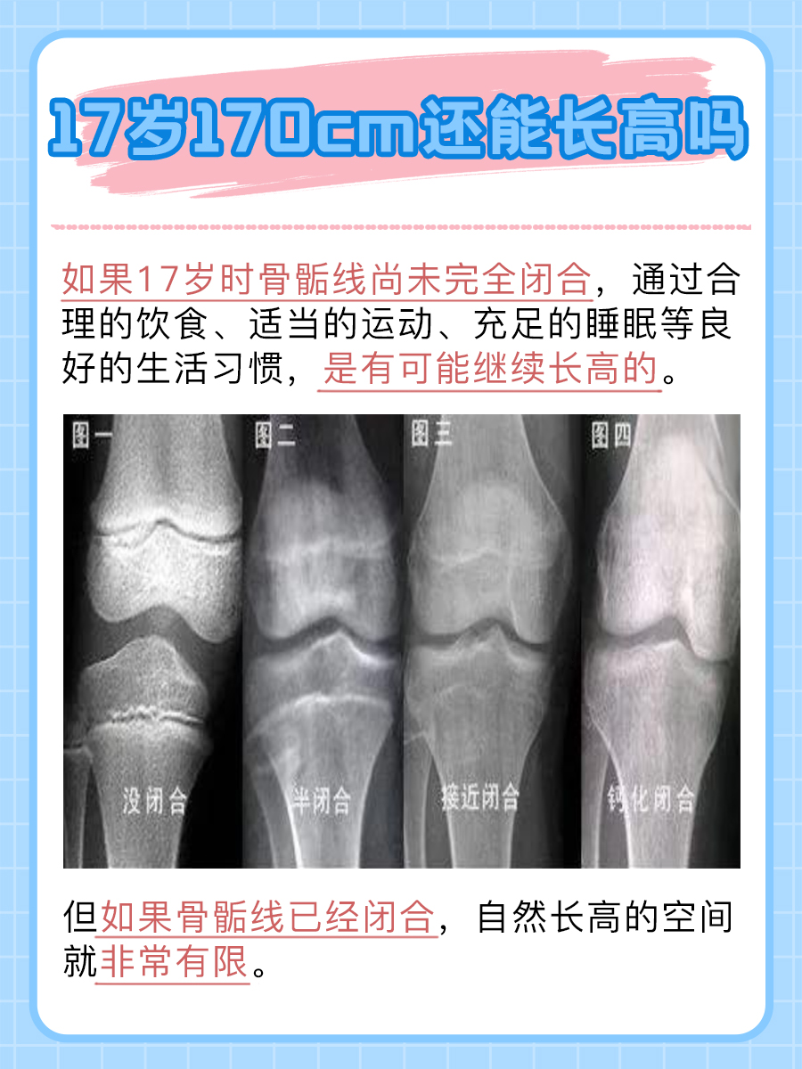 17岁170cm还能长高吗 ？一文揭秘