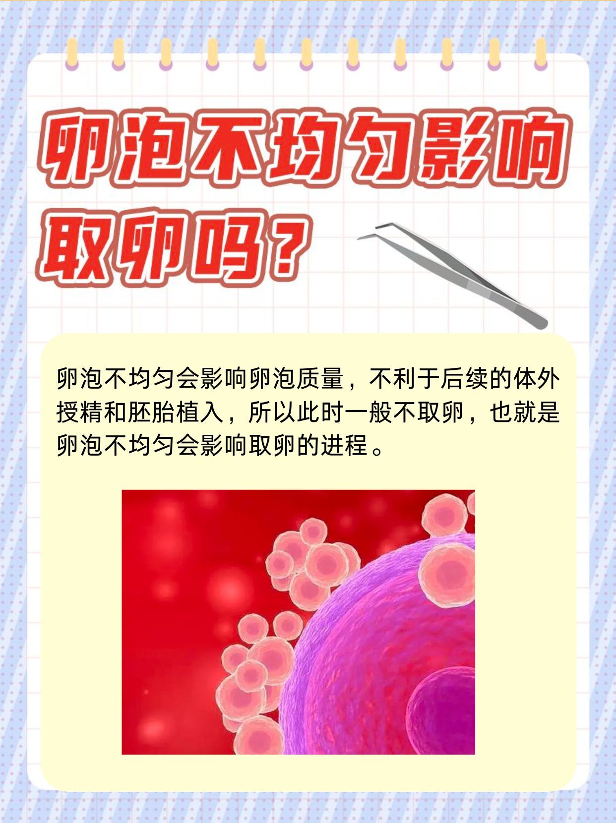 猜你不知道—卵泡不均匀影响取卵吗？