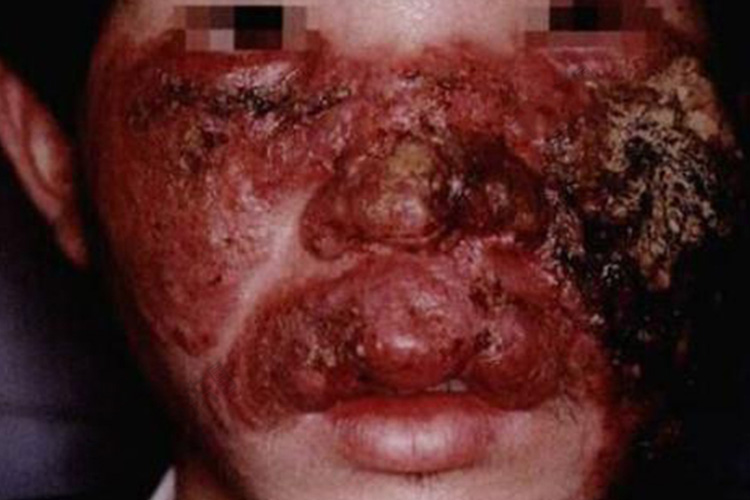 综合性皮肤皮损图