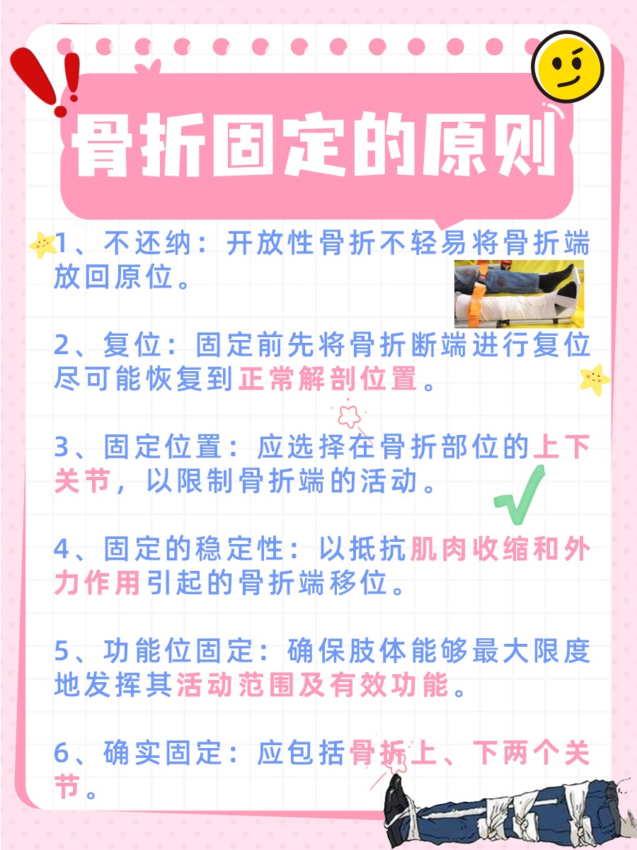 骨折固定原则，正确处理方法一览