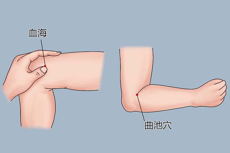 血海穴、曲池穴位置图