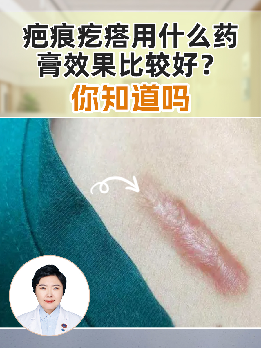 疤痕疙瘩用什么药膏效果比较好，你知道吗