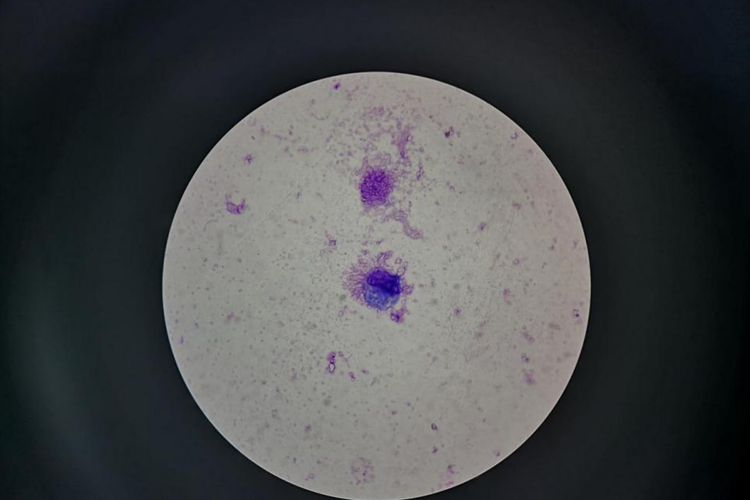 瑞士染色滴虫图