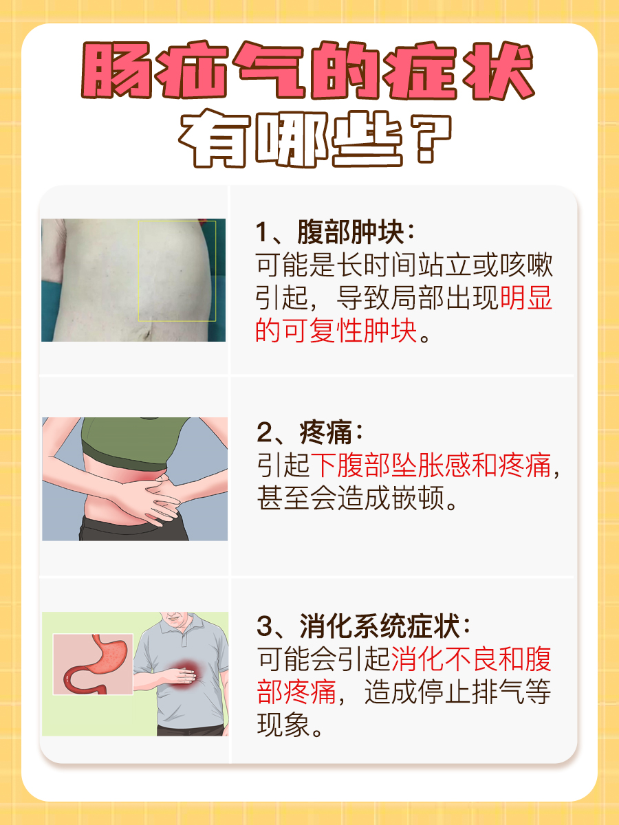 肠疝气的症状及治疗，你知道吗？