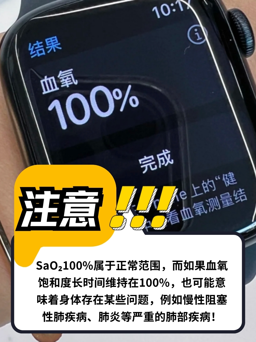 速戳！经常看到的SaO₂究竟是什么意思？