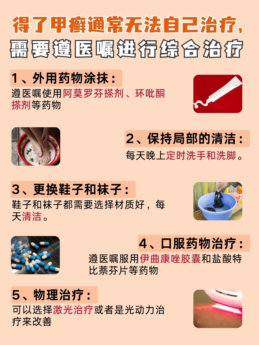 得了甲癣，自己怎么治疗？