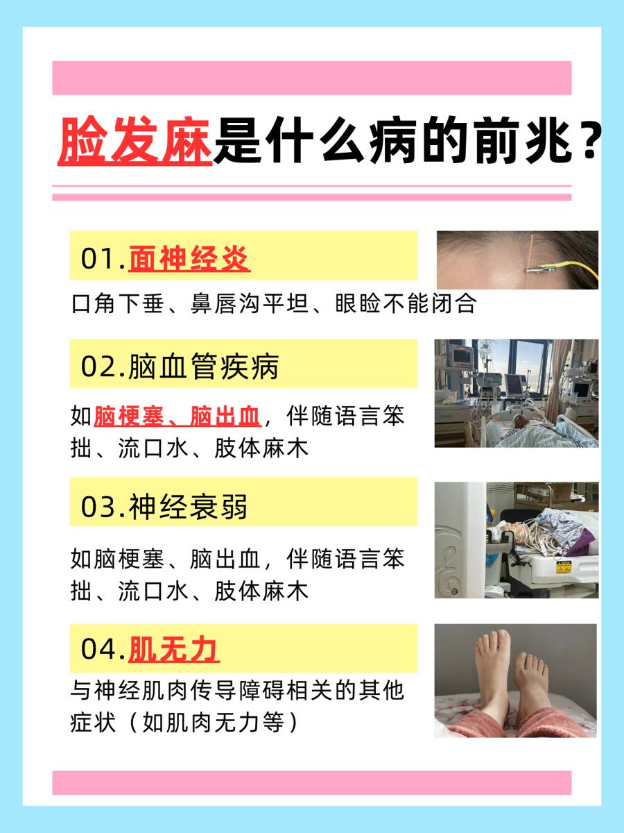 脸部发麻咋回事？是什么病的预警信号？