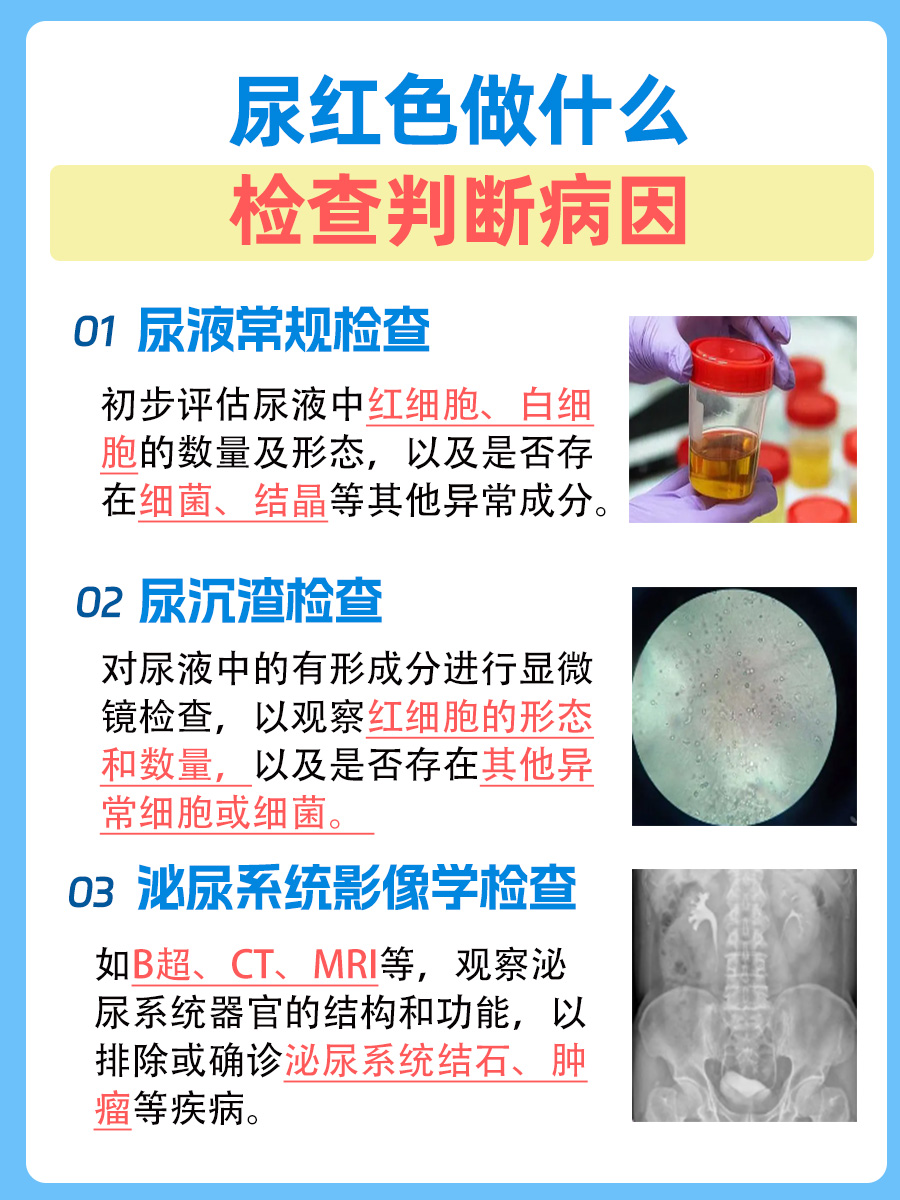 尿红色是什么原因？医生为你解答！