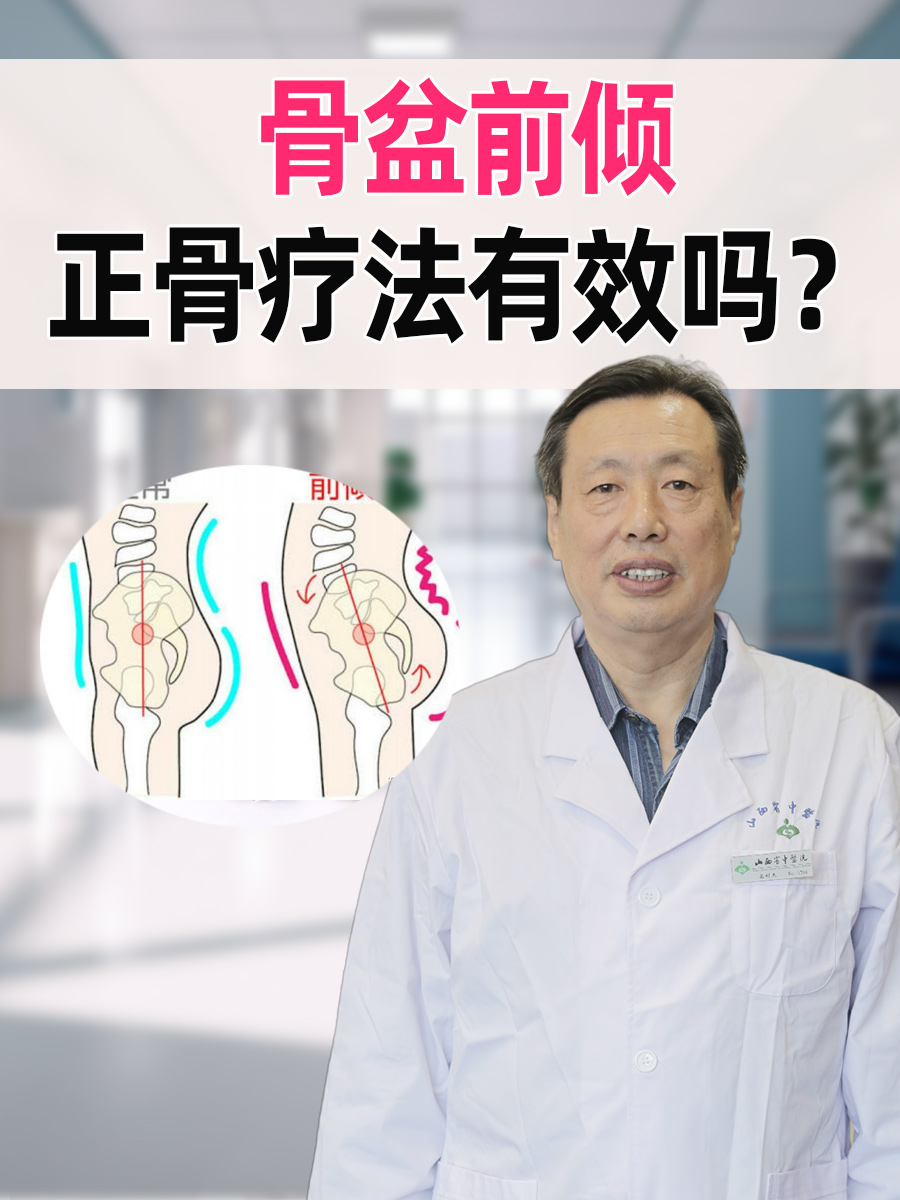 骨盆前倾，正骨疗法有效吗？