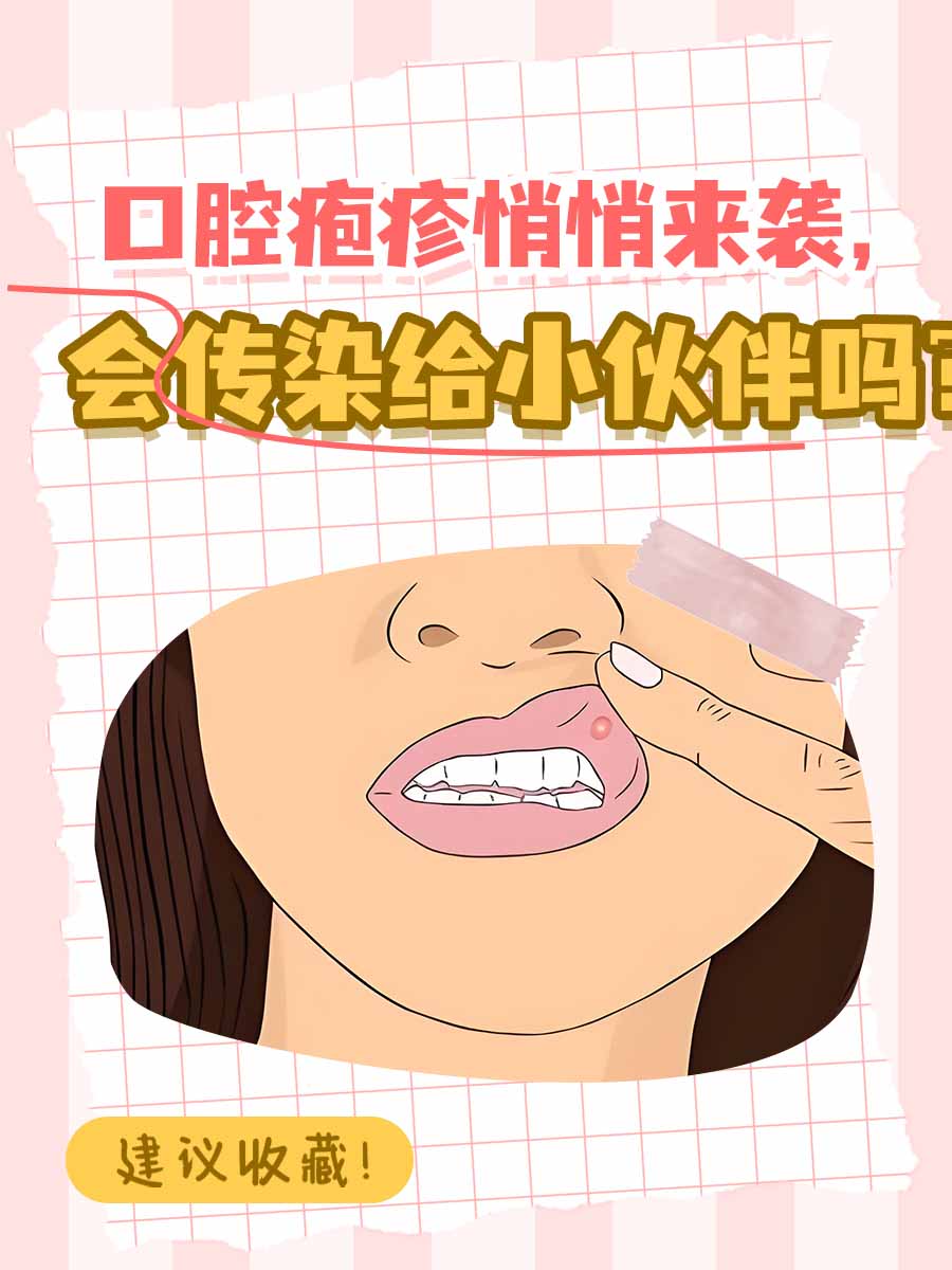 口腔疱疹悄悄来袭，会传染给小伙伴吗？