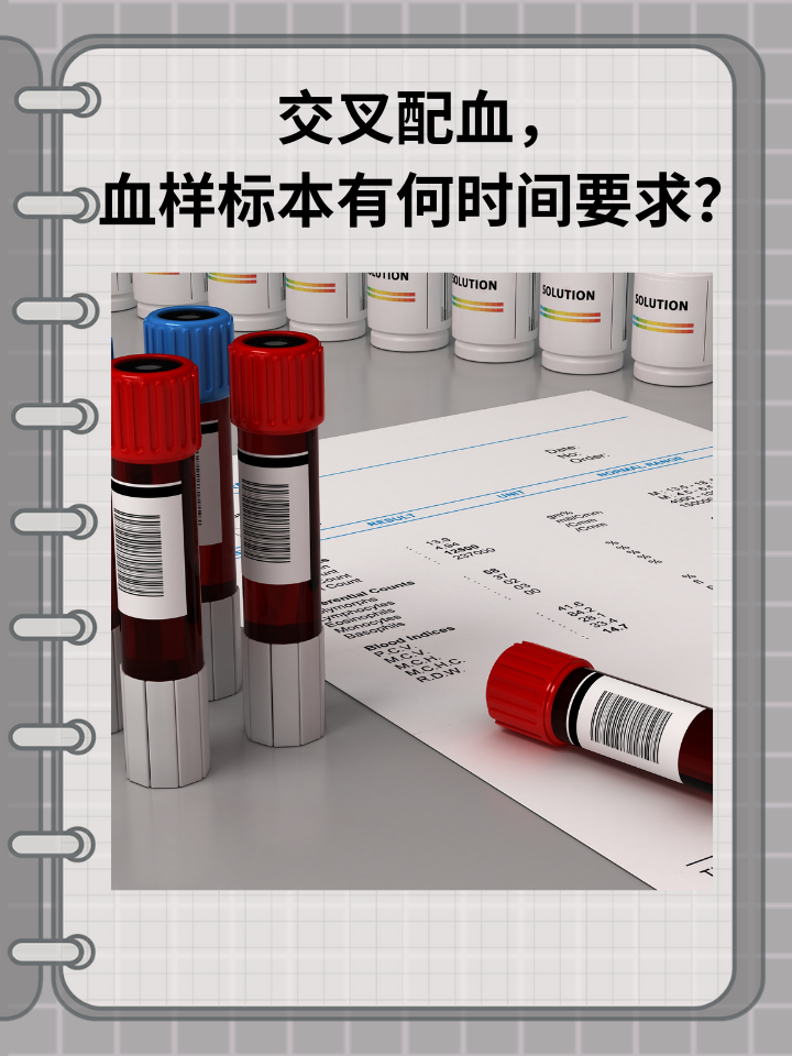 交叉配血，血样标本有何时间要求？