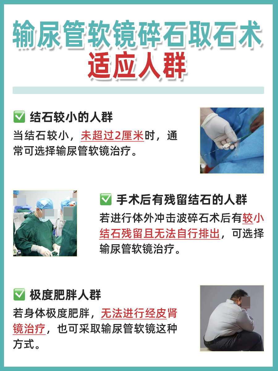 医生解答:软镜取肾结石全过程