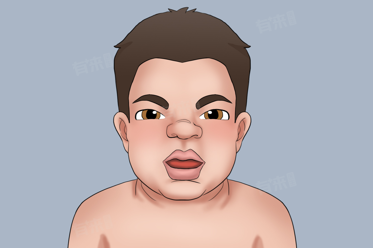 孩子甲减症状表现-有来医生