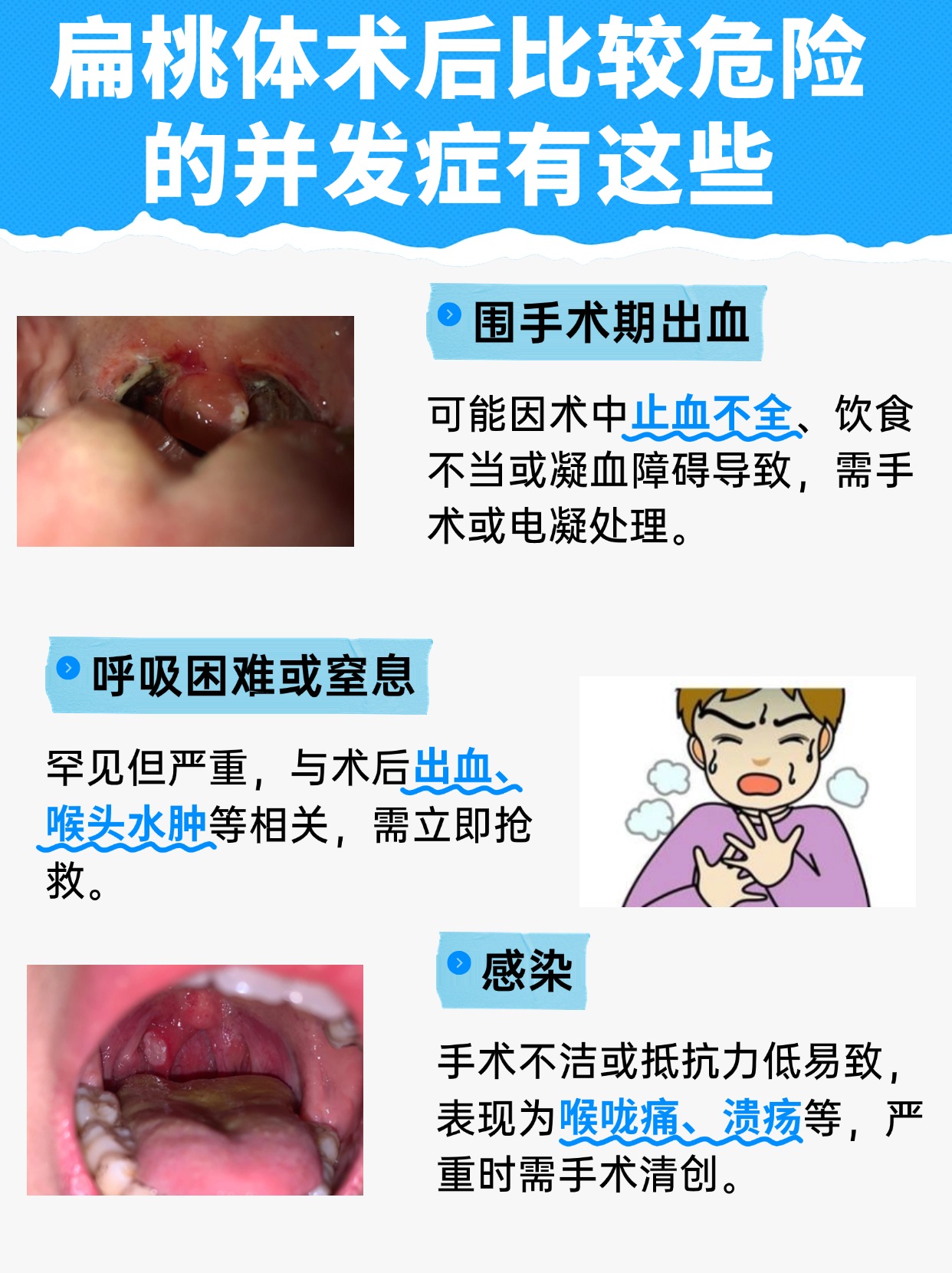 扁桃体术后比较危险的并发症是什么？你是否中招
