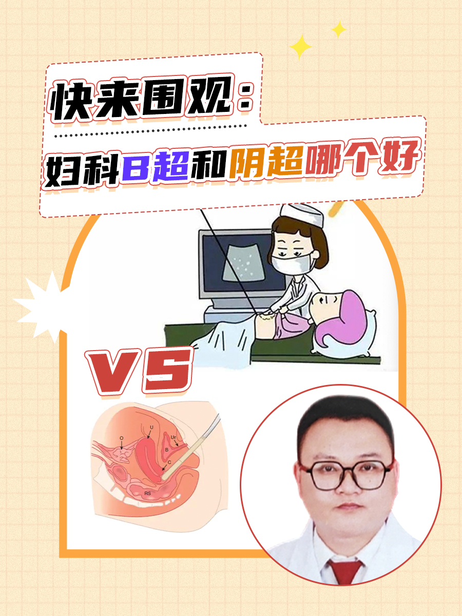 快来围观：妇科B超和阴超哪个好