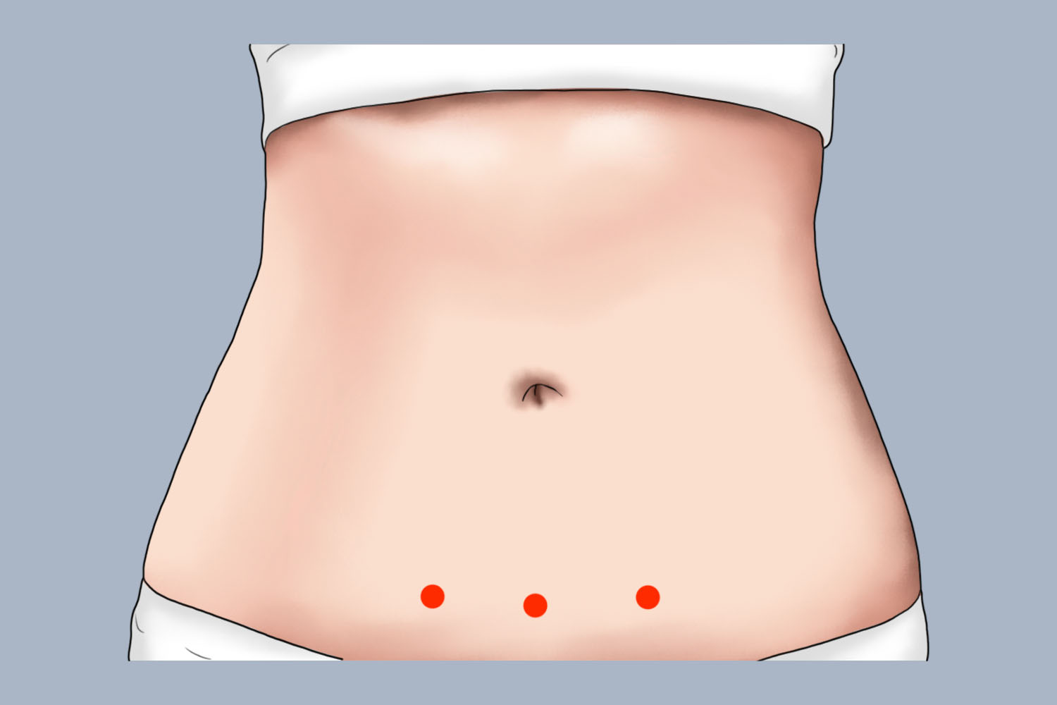 11周胎心位置图