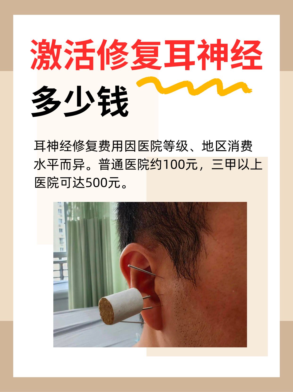 激活修复耳神经费用知多少？一文告诉你