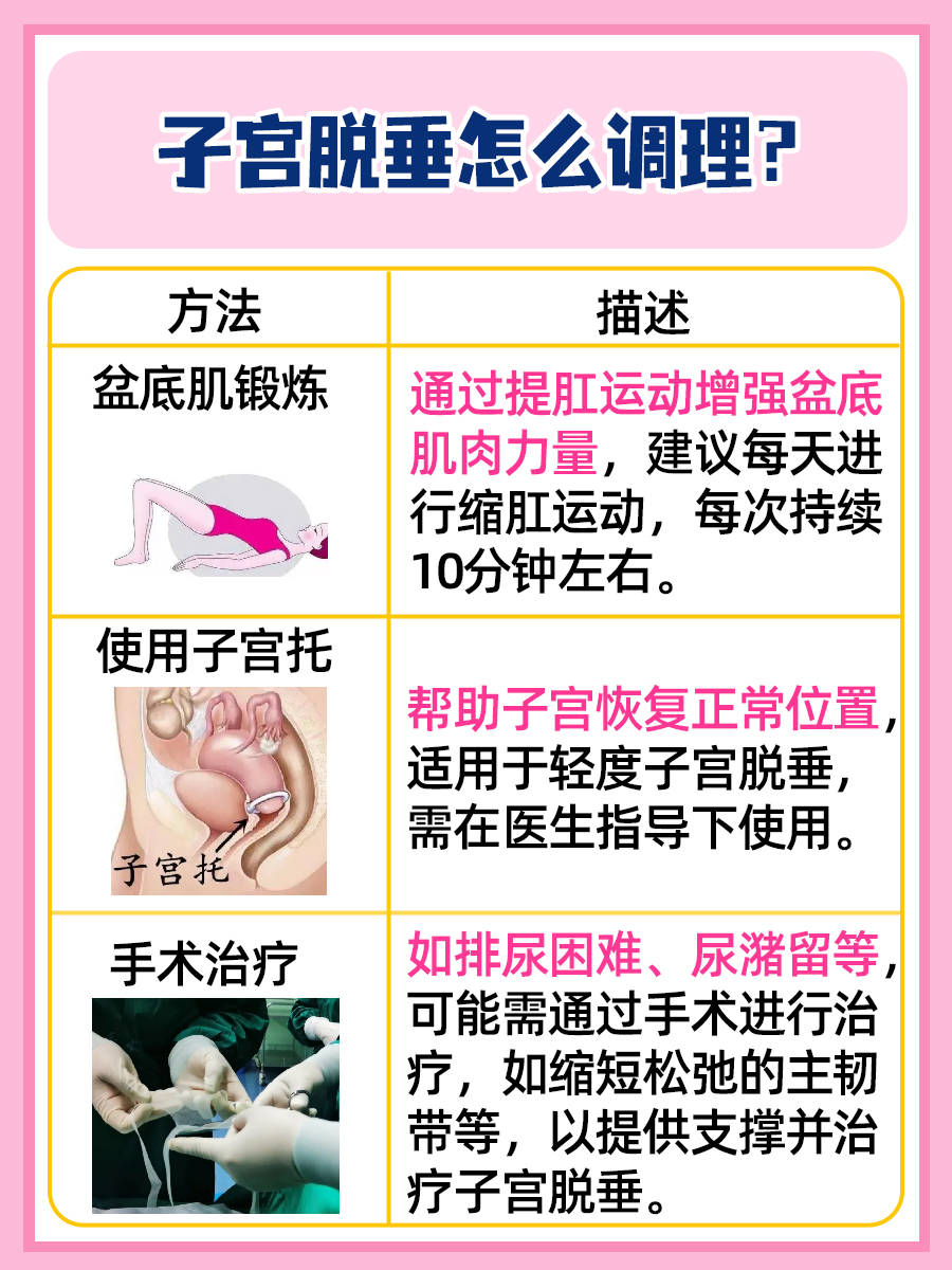 轻松调理，告别子宫脱垂烦恼